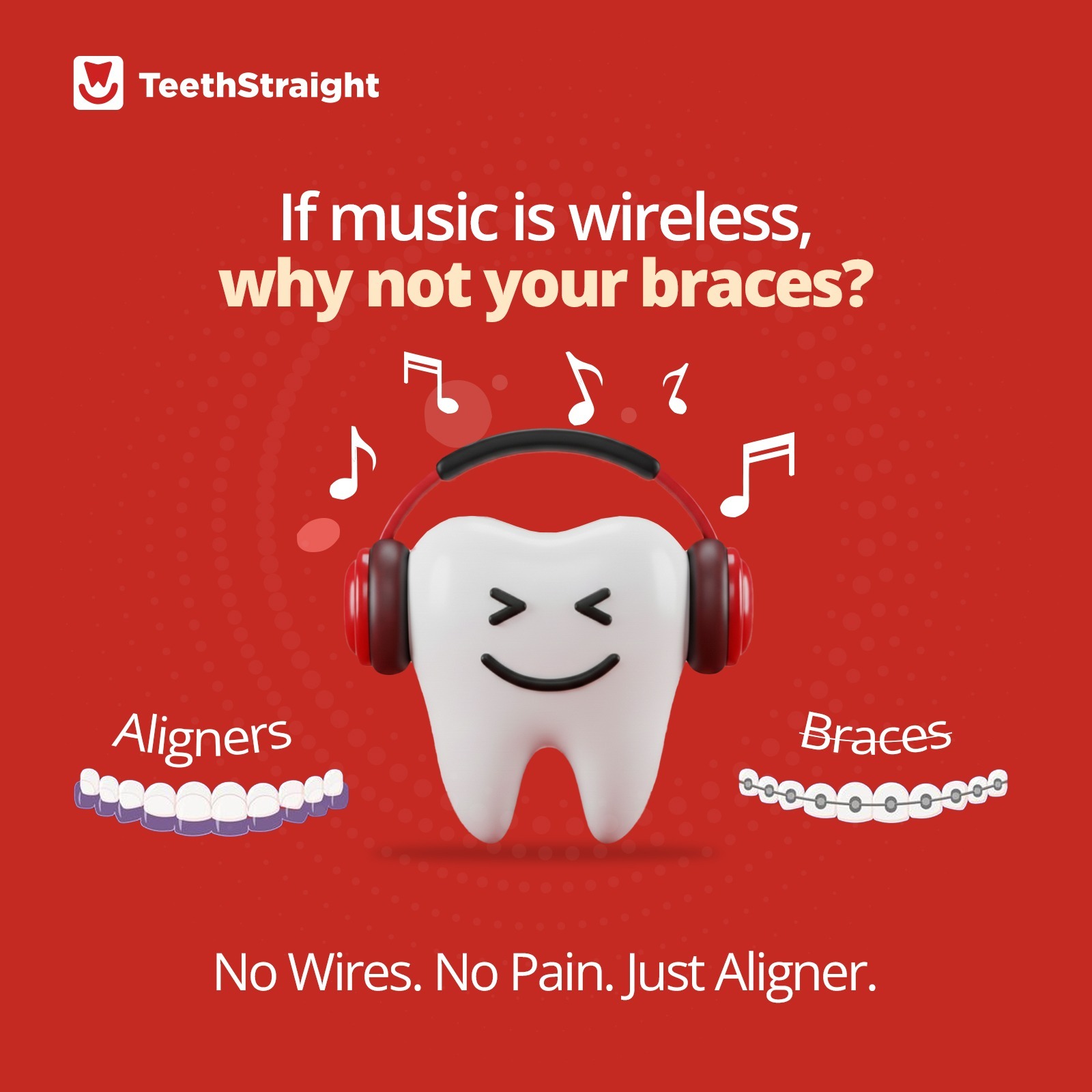 Straightening Teeth Without Braces