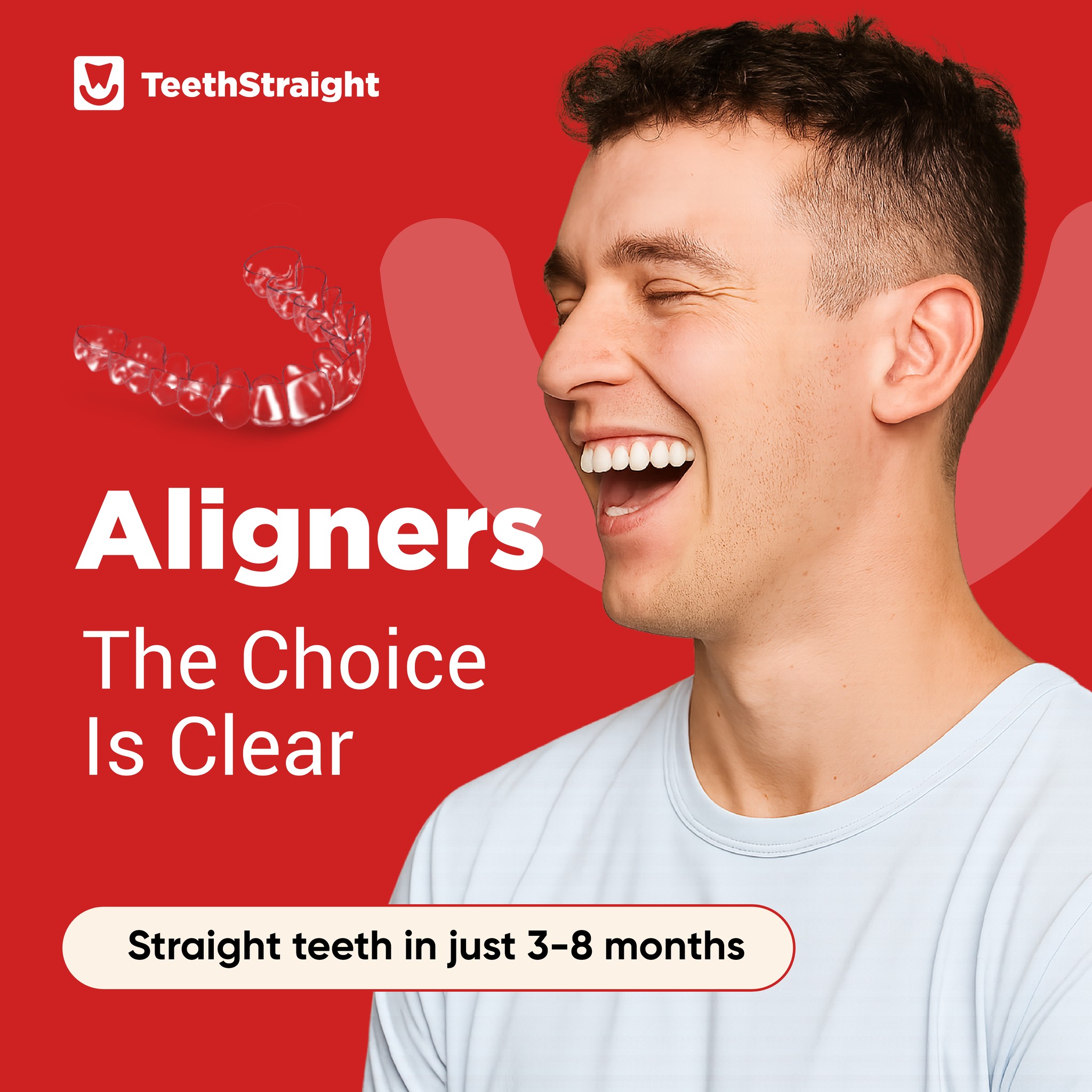 Aligners the choice is clear