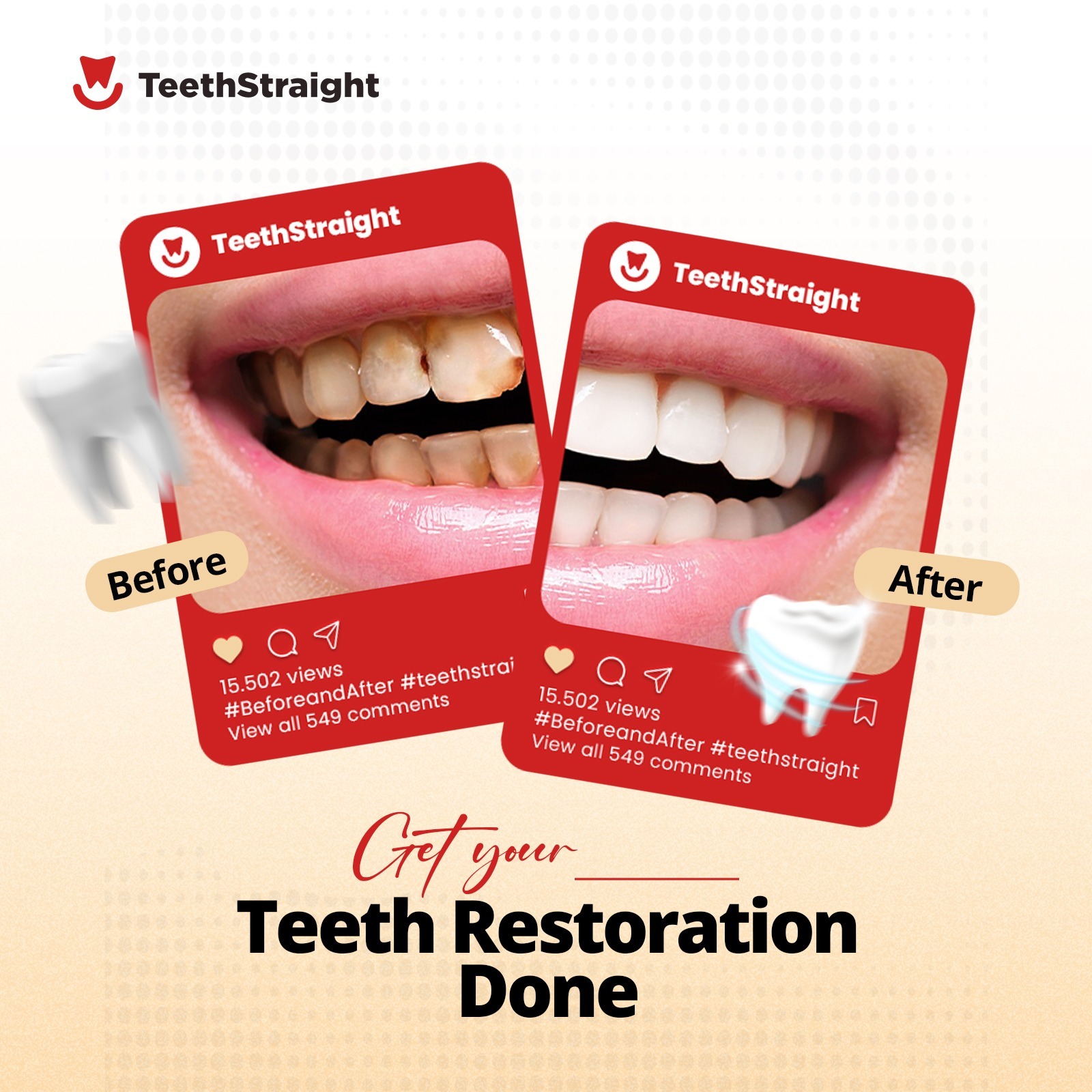 Teeth Restoration