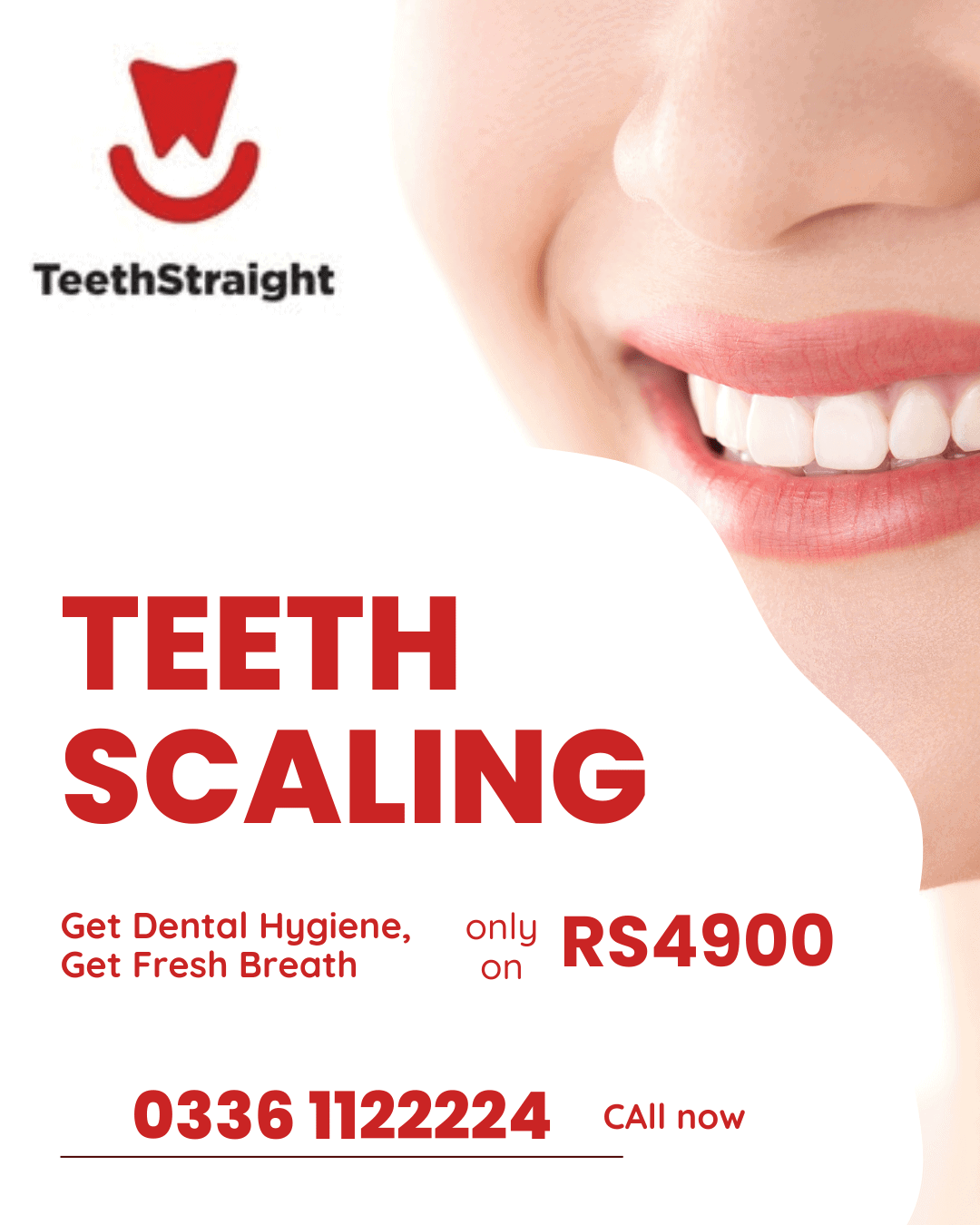 teeth scaling and polishing